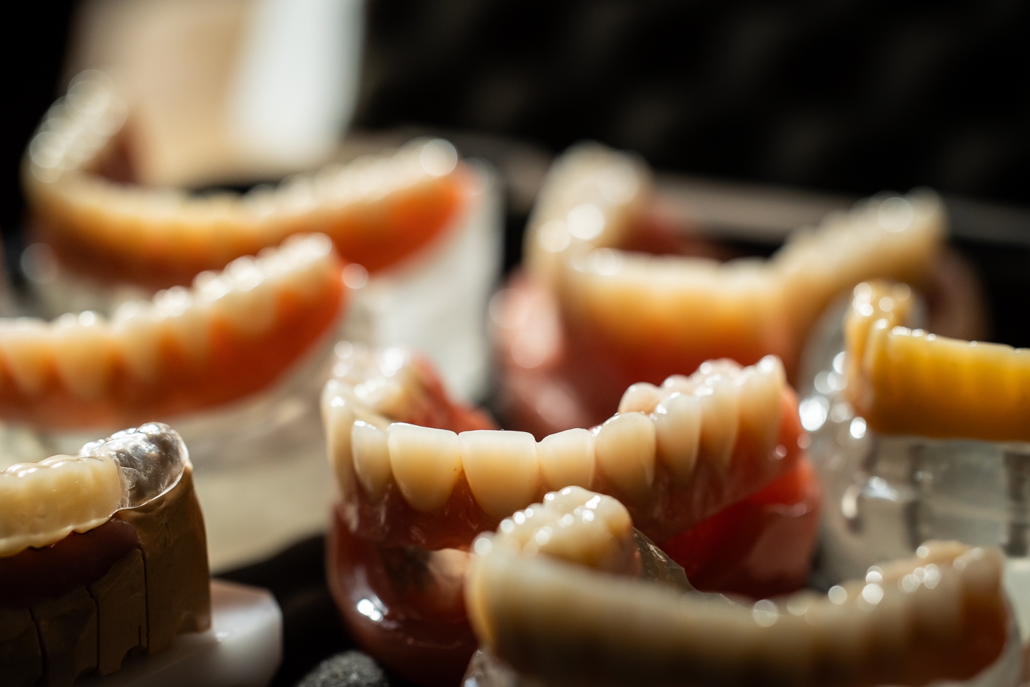 Teleskoptechnik – Dentalmanufaktur Arnold